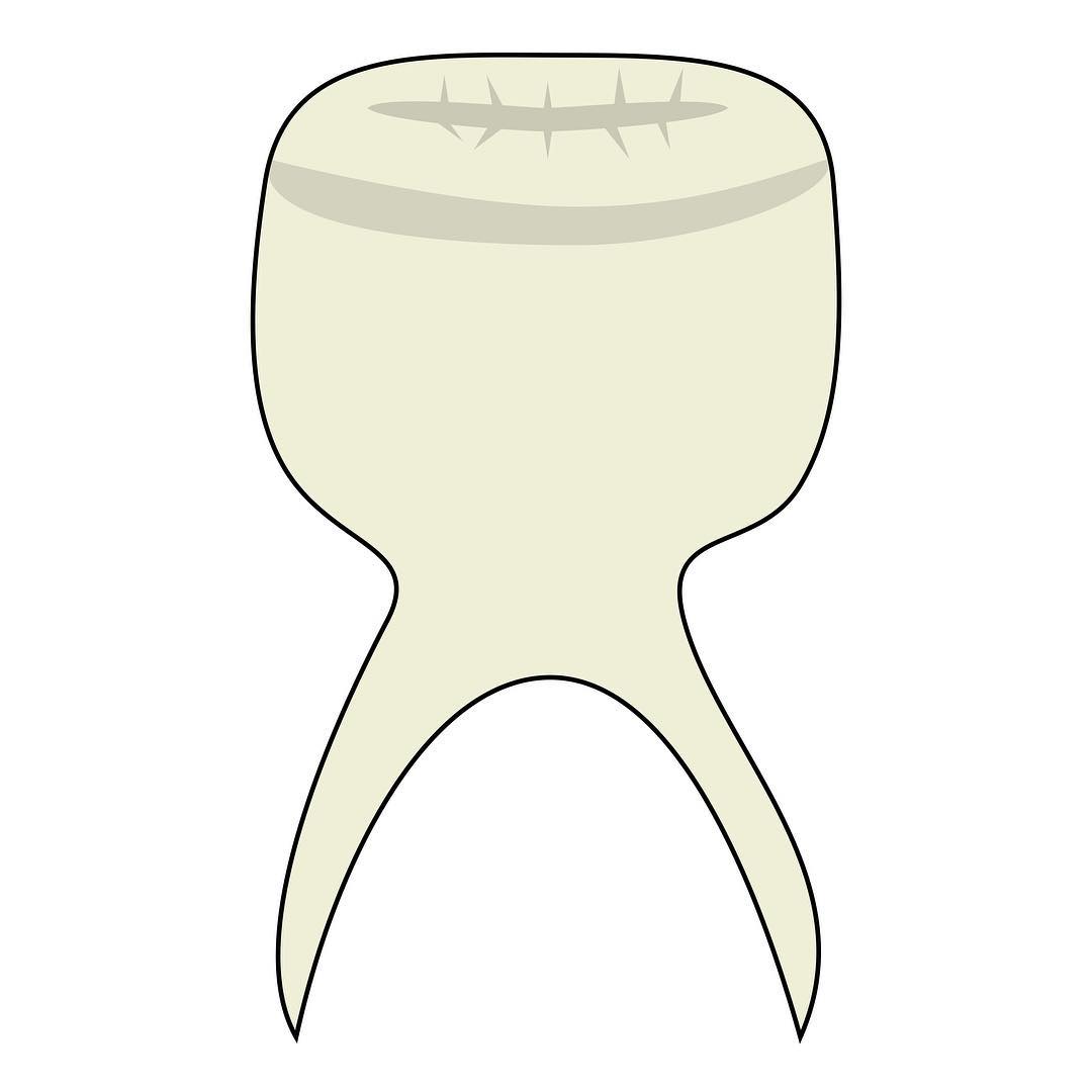 my_tooth_assembly