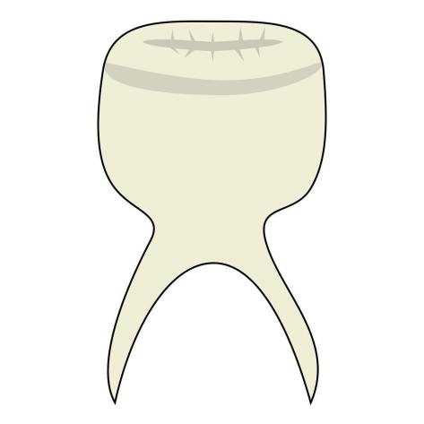 my_tooth_assembly